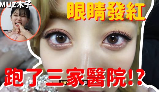 【TWICE】因為眼睛發紅而跑了三間醫院的志效!? 假裝睡覺咬SANA手指的定延